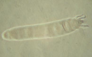 Eriophyes magnus Wang & Huang, 2011 巨大節蜱
