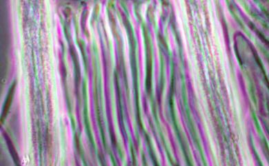 Coccomyces taiwanensis C. L. Hou, R. Kirschner & C.J. Chen 臺灣齒裂菌