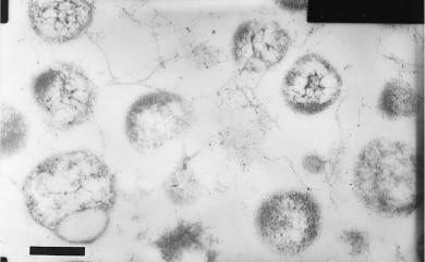 Methanococcus voltae Balch & Wolfe 1981