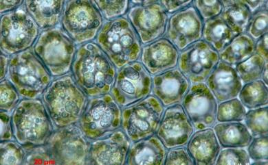 Cololejeunea spinosa 刺疣鱗蘚