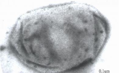 Methanocorpusculum parvum Zellner et al. 1988