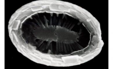 Coronosphaera mediterranea 地中海花冠球藻