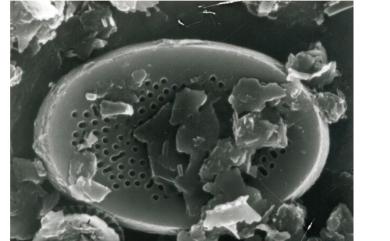 Pontosphaera discopora J.Schiller