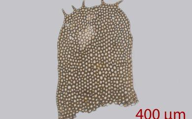 Heteroscyphus argutus (Reinw., Blume & Nees) Schiffn. 四齒異萼蘚