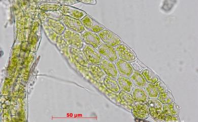 Cololejeunea diaphana A.Evans