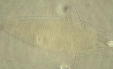 Aculops yushanus (Huang, 2001) 玉山刺皮節蜱