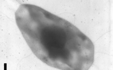 Methanocalculus chunghsingensis Lai et al. 2004