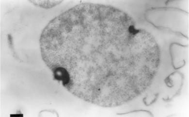 Methanocalculus chunghsingensis Lai et al. 2004