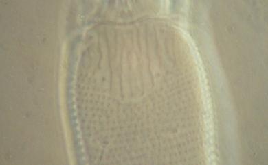 Phytoptus formosanus Wang & Huang, 2011 蓬萊植羽節蜱