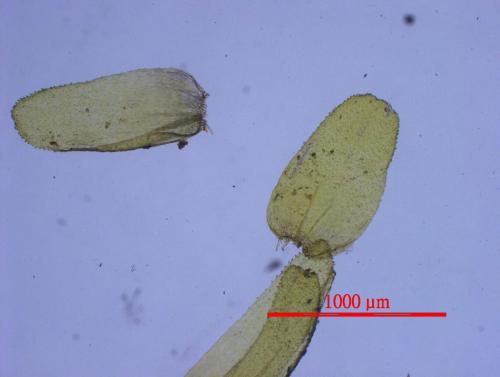 Glossadelphus lingulatus (Cardot) M. Fleisch. 葉片顯微照