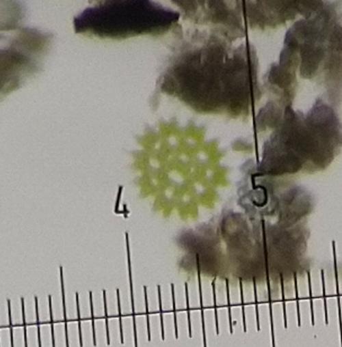 Pediastrum duplex Pediastrum duplex