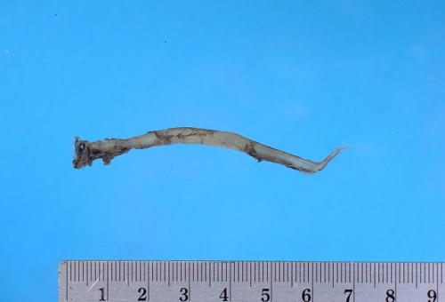 ASIZP0063983