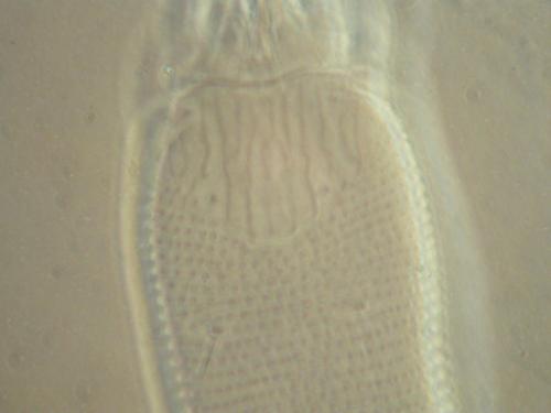 Phytoptus formosanus Wang & Huang, 2011硬皮板