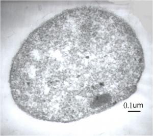 <a href="https://taieol.tw/muse/digi_object/05cc3ca2f10de744daa1fded41876968" target="_blank">Methanocorpusculum parvum／By：賴美津／國立中興大學生命科學系太古生物研究室</a>